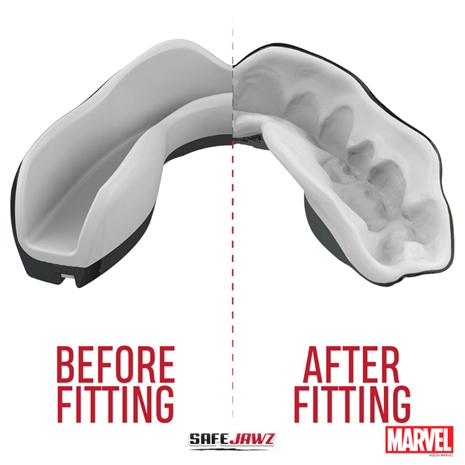 SafeJawz Marvel Venom Mouthguard Refit