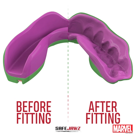 SafeJawz Marvel The Hulk Mouthguard Refit