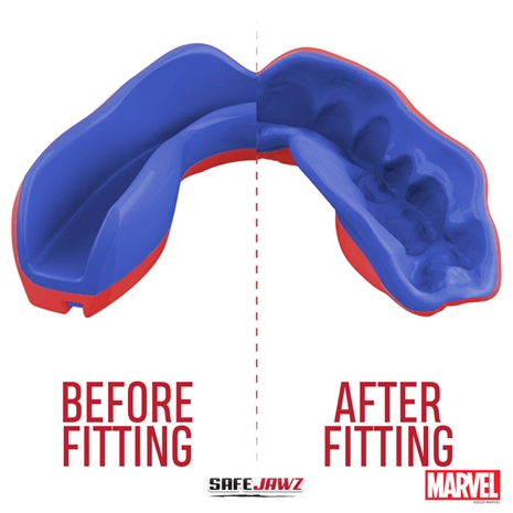 SafeJawz Marvel Spider-Man Mouthguard Refit
