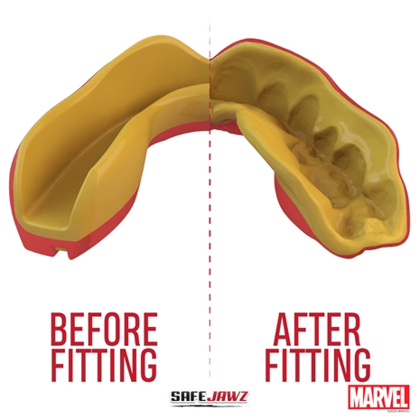 SafeJawz Marvel Iron-Man Mouthguard Bottom Refit